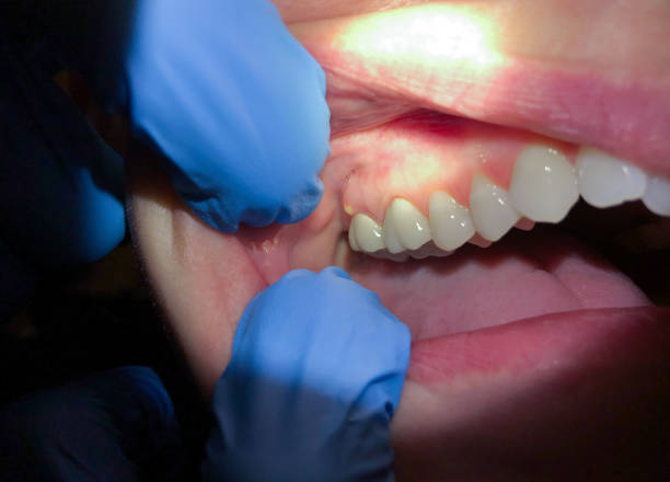 Best Cracked Tooth Emergency Dentist  in Margate City, NJ